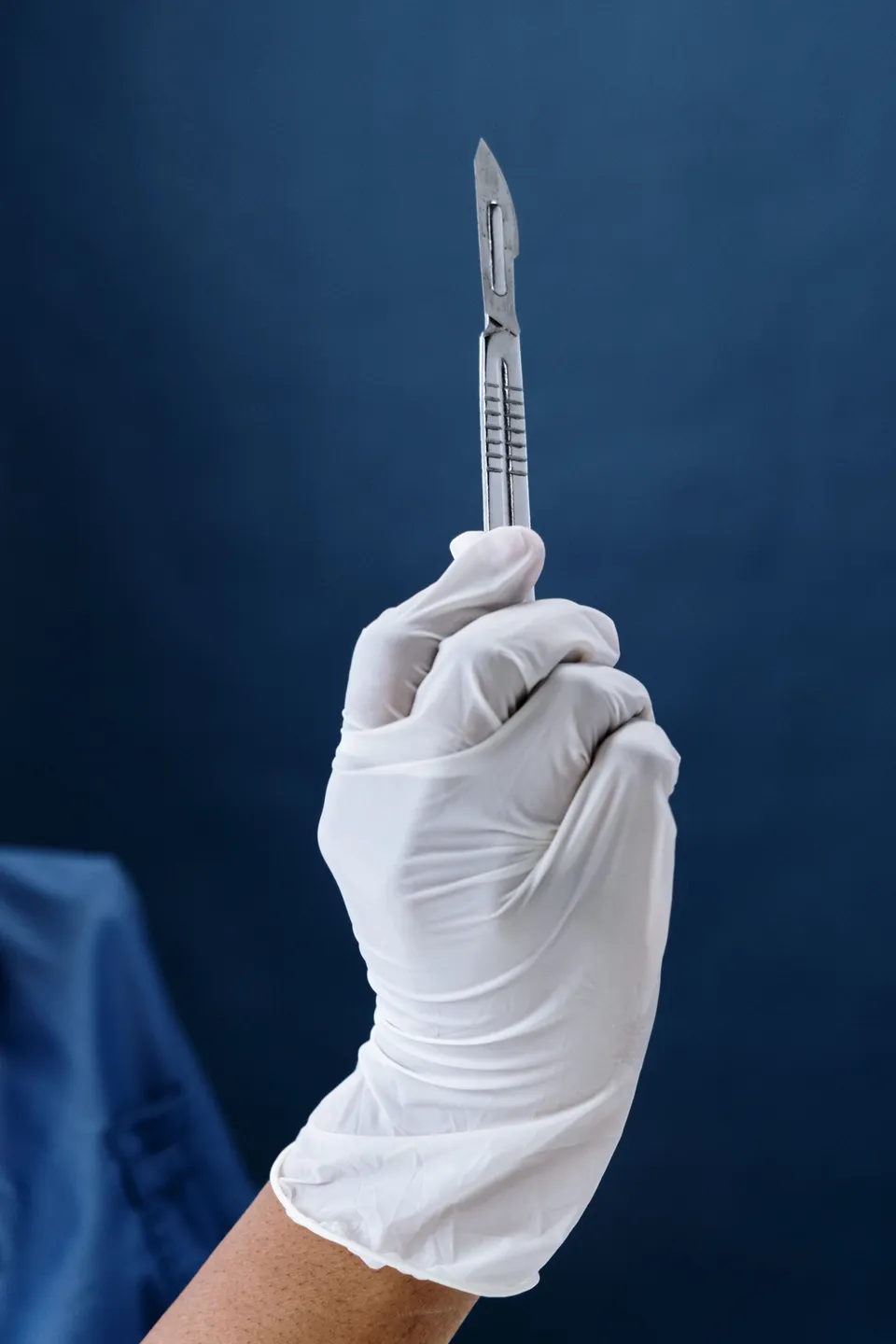 A surgeon's gloved hand holding a scalpel.